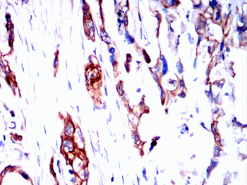BCL2A1 Antibody