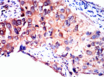 GLI1 Antibody