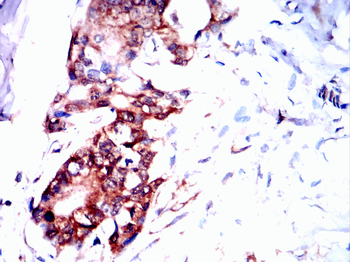 ITGAV Antibody