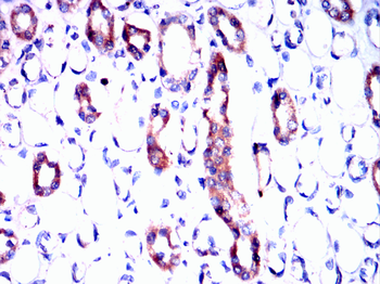 CNP Antibody