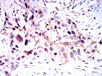 CNP Antibody