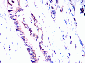 CNP Antibody