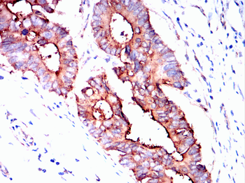 IFITM3 Antibody