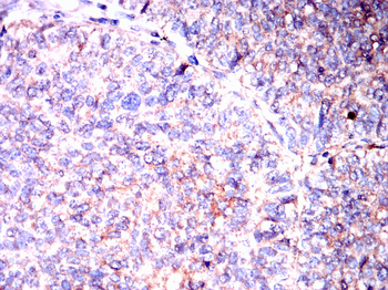 CXCR3 Antibody