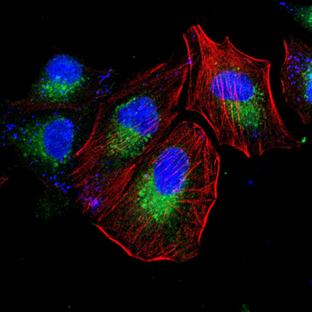 LDHB Antibody