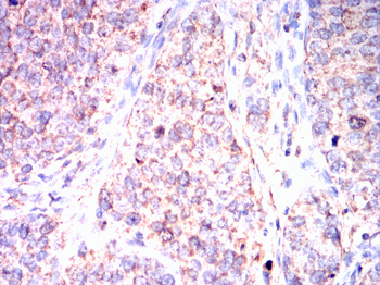 LDHB Antibody