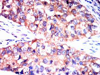 LDHB Antibody