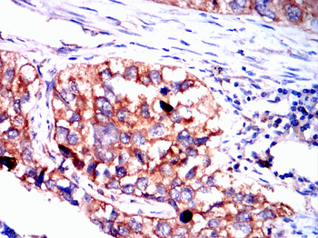 YBX1 Antibody