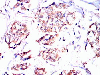 HSPH1 Antibody