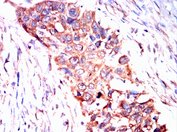 HSPH1 Antibody