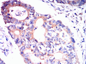 HSPH1 Antibody