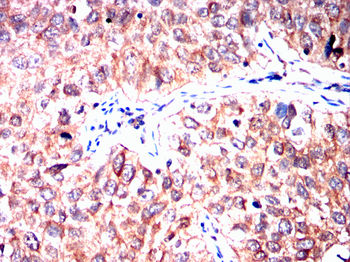 PDX1 Antibody