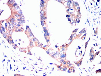 PDX1 Antibody