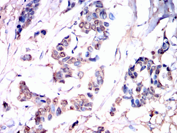 FKBP5 Antibody