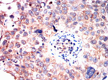 FKBP5 Antibody