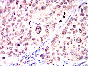 STAT5A Antibody