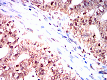 STAT5A Antibody
