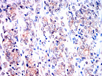 STAT5A Antibody