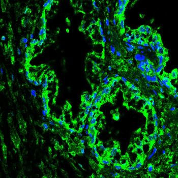 STAT5A Antibody