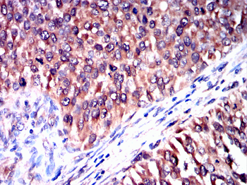TOP2A Antibody