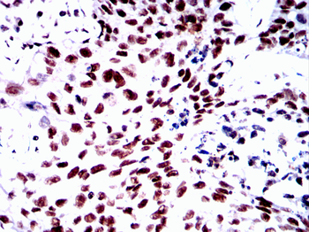 MAPK9 Antibody