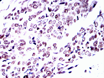MAPK9 Antibody