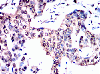 HNRNPK Antibody