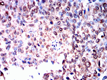 HNRNPK Antibody