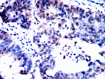 HNRNPK Antibody