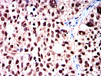 HNRNPK Antibody