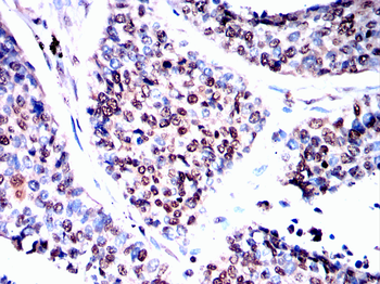 HNRNPK Antibody