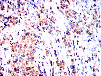 HNRNPK Antibody