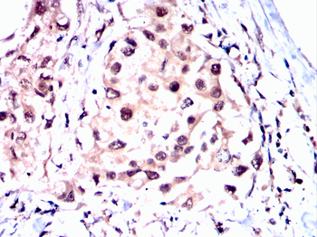 EIF2AK2 Antibody