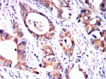 HPRT1 Antibody