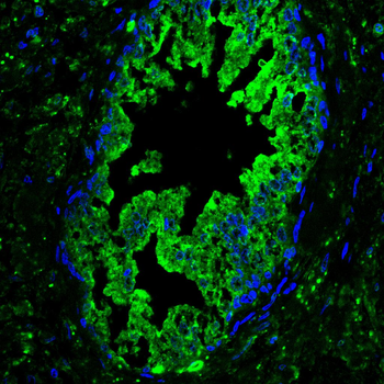 PFKM Antibody