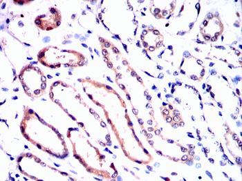 HTT Antibody
