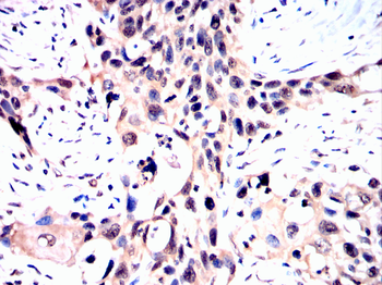 HTT Antibody
