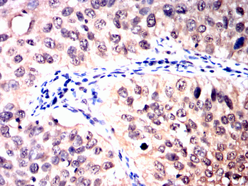HTT Antibody