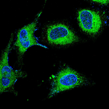 DSG2 Antibody