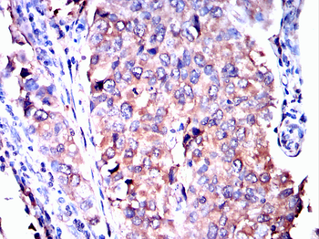 DSG2 Antibody