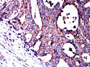DSG2 Antibody