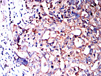 DSG2 Antibody