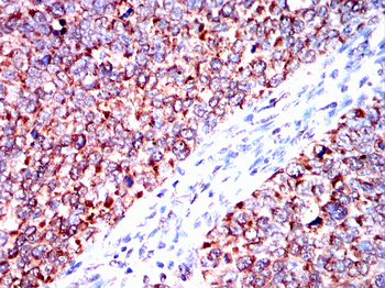 ELAVL1 Antibody