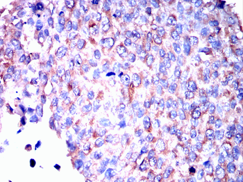 USP11 Antibody