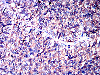 USP11 Antibody