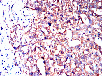 USP11 Antibody