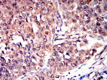 ACHE Antibody
