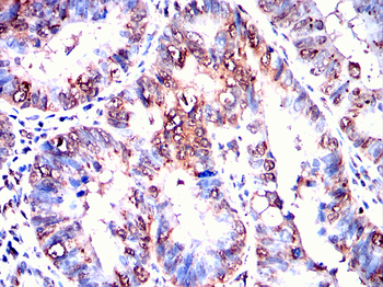 PSMC2 Antibody