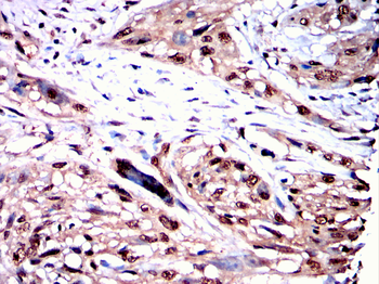 PSMC2 Antibody