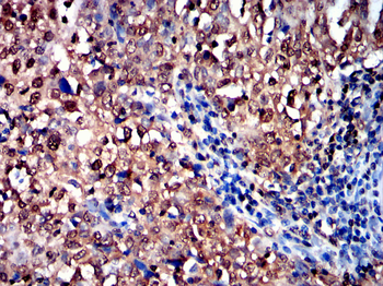 PSMC2 Antibody
